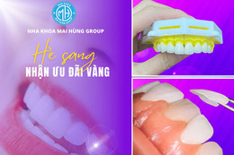 Làm răng sứ tại Nha khoa Mai Hùng Group, ưu đãi đến 50%