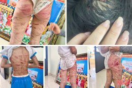 Hà Tĩnh: Cô hiệu trưởng thông tin về bé gái lớp 5 nghi bị bố dượng bạo hành dã man