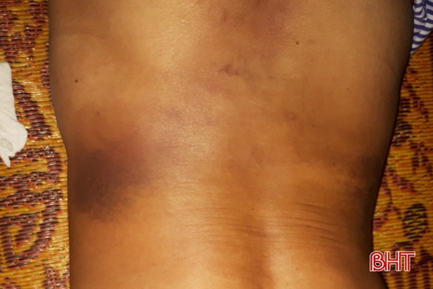 Nhắc nhở việc thả trâu bò phá hoại cảnh quan, trưởng thôn bị đánh nhập viện