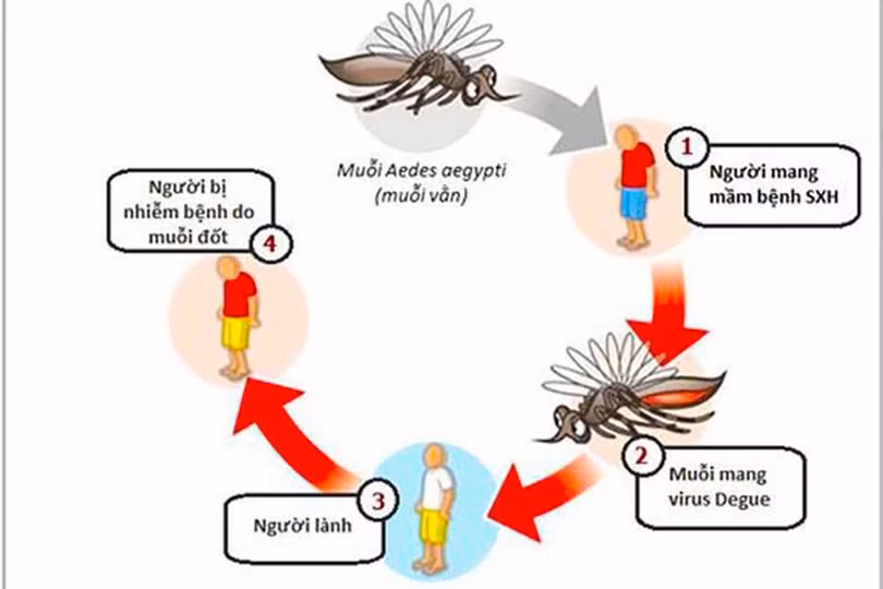 sốt xuất huyết. 1.jpeg