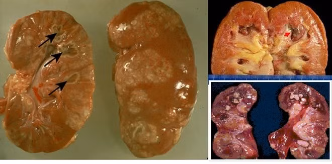 ton hai suc khoe vi duong