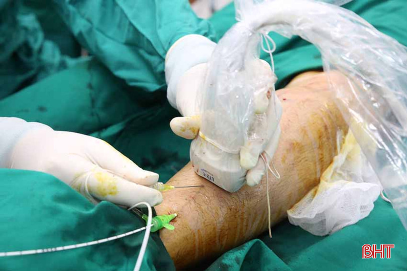 Phương pháp Laser có khả năng loại bỏ hầu hết các triệu chứng bệnh giãn tĩnh mạch như đau nhức, nặng nề, nổi gân xanh… z5432903465055_3037c790845a374d9eebe55ddc03c3cf.jpg