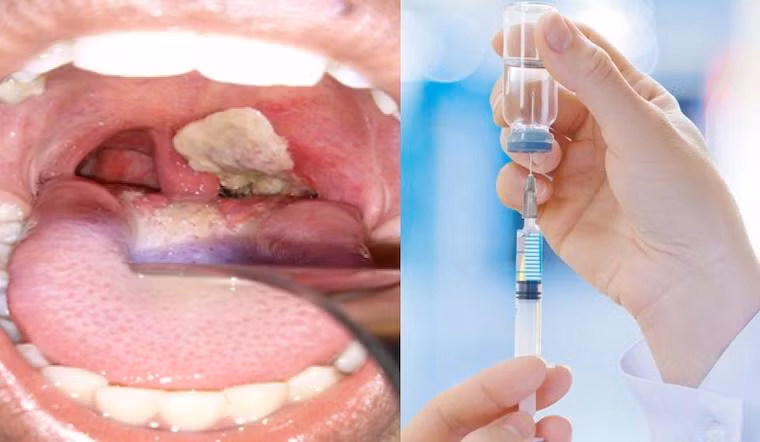 Người dân không tự ý tiêm chủng vaccine chứa thành phần bạch hầu khi chưa có hướng dẫn, khuyến cáo cụ thể của của cơ quan y tế trong vùng có dịch và theo hướng dẫn của từng loại vaccine có chứa thành phần bạch hầu.