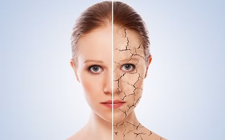 10 căn bệnh của mùa Đông mà ai cũng có thể mắc phải