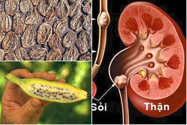 Thuốc từ các loài chuối 1 Lợi ích bất ngờ từ các loại chuối