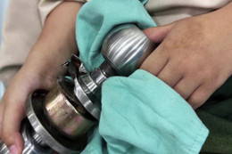 Bác sĩ phá ổ khóa cửa giải cứu ngón tay bé 5 tuổi