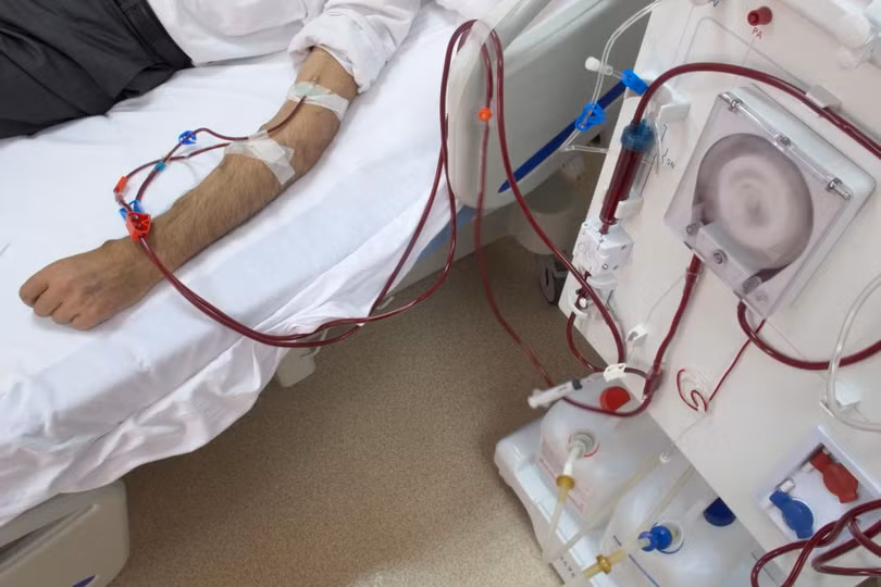 Suy thận do uống cỏ mực, dấu hiệu cảnh báo căn bệnh này