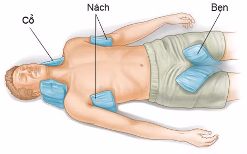 cach du phong va so cuu khi bi soc nhiet do nang nong
