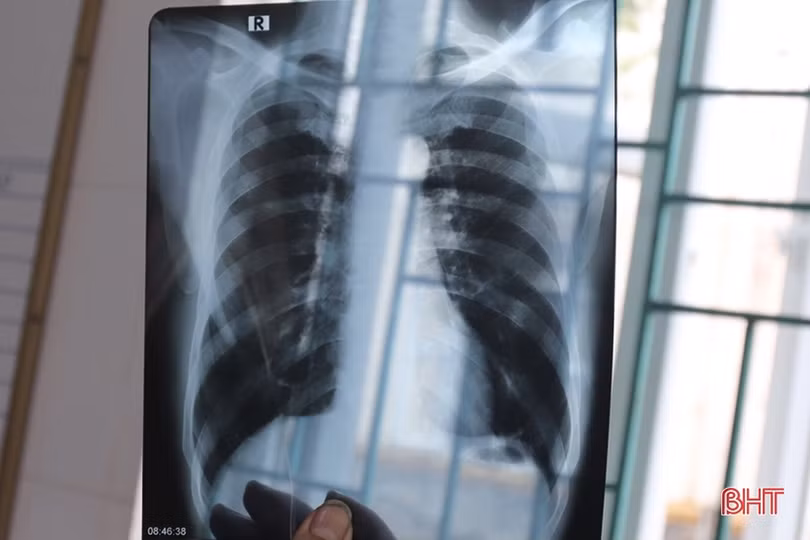 Từ bỏ thuốc lá vì hạnh phúc gia đình