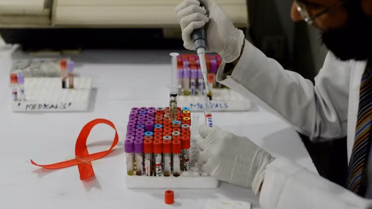 cac nha nghien cuu cuba thu nghiem vac xin dieu tri hiv aids