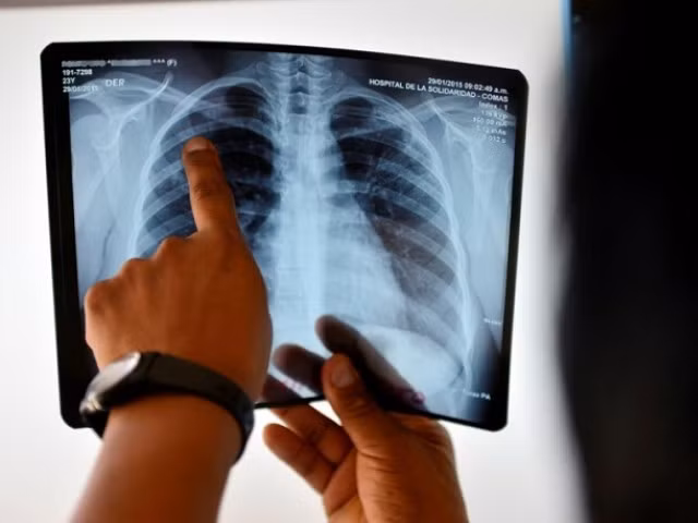 Trí tuệ nhân tạo có thể chẩn đoán bệnh như bác sĩ