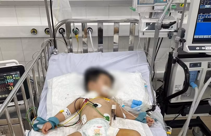 Trẻ mắc bệnh tay chân miệng nặng được điều trị tích cực tại Bệnh viện Nhi đồng 1, TP HCM. Ảnh: Anh Đào