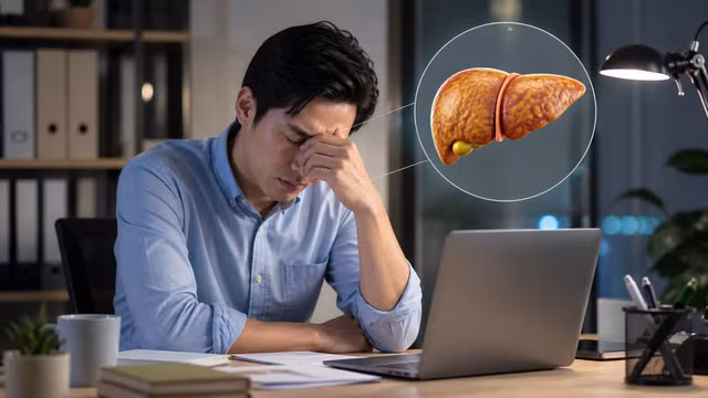Mệt mỏi kéo dài ở dân văn phòng có thể liên quan đến gan nhiễm mỡ. Ảnh minh họa