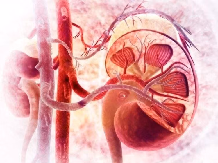 Người phải lọc máu trong thời gian dài có nguy cơ mắc ung thư thận