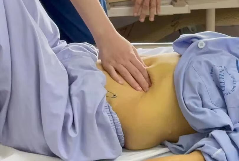 Bác sĩ thăm khám cho bệnh nhân viêm gan nhiễm độc cấp nặng liên quan đến việc sử dụng thuốc không rõ nguồn gốc. Ảnh: BVCC.
