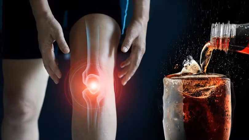 Người trẻ hiện nay tiêu thụ nước ngọt có gas nhiều hơn, khiến nguy cơ giảm mật độ xương xuất hiện từ rất sớm.