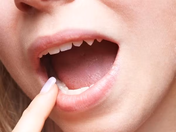10 dau hieu ung thu de dang bi bo qua