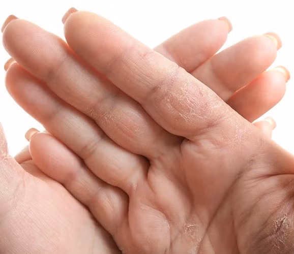 10 thay đổi cảnh báo tình trạng sức khỏe mà bạn cần chú ý
