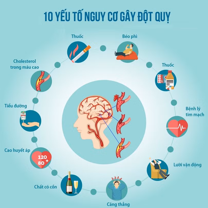 đột quỵ 1.jpg