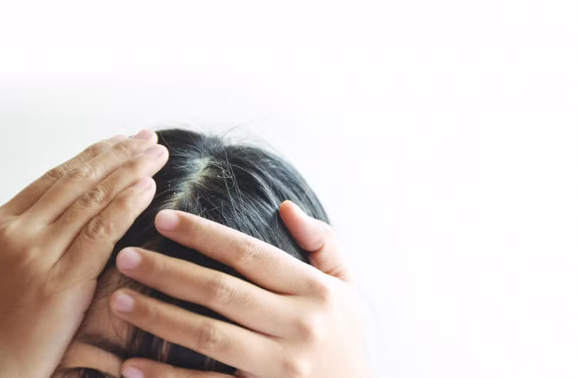 Tự nhuộm tóc bạc coi chừng rước họa