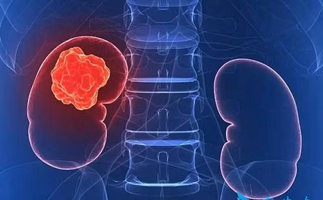 8 dấu hiệu phổ biến cảnh báo ung thư
