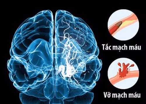 Phòng tránh nguy cơ ngất xỉu do nắng nóng