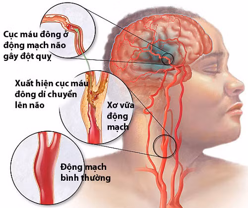phong ngua dot quy nao khi troi lanh gia