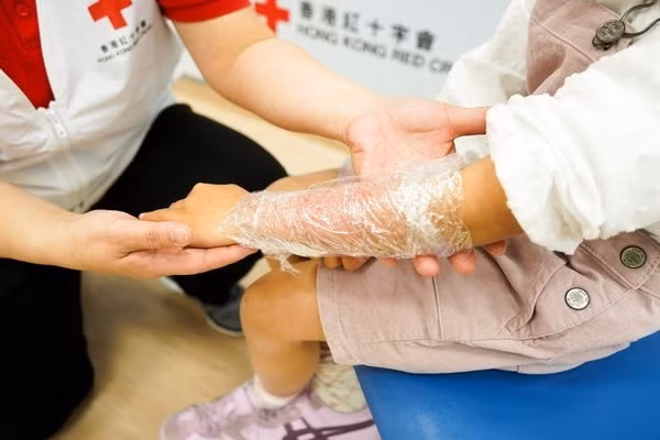 Đây là phương pháp sơ cứu vết bỏng chuẩn nhất cho trẻ nhỏ mà bố mẹ rất nên nhớ