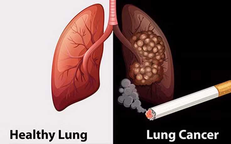 Cần tăng số lượng biển cấm hút thuốc lá, đặt ở vị trí dễ nhận biết