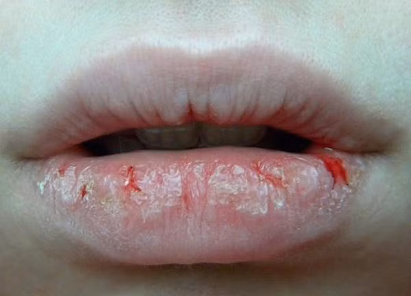 Giữ cho môi mượt, mềm khi thời tiết khô hanh