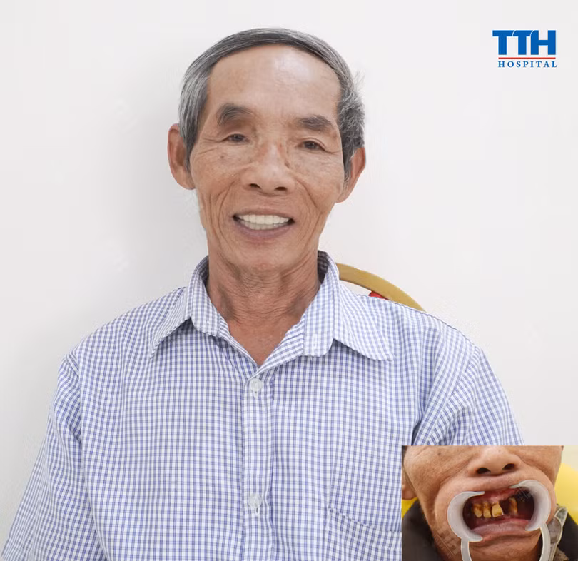 Cơ hội “vàng” cho người dân Hà Tĩnh trồng răng Implant tại Bệnh viện Thái Thượng Hoàng – TP. Vinh