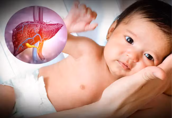 Làm gì để phát hiện sớm trẻ mắc viêm gan bí ẩn?