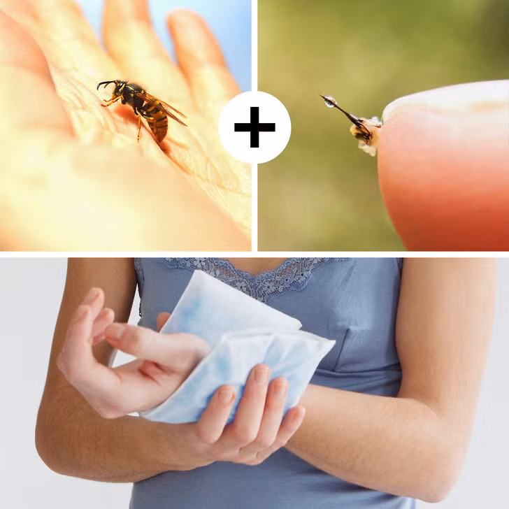 11 mẹo sơ cứu ban đầu bạn nên biết