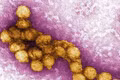 Bỉ ghi nhận 2 ca tử vong đầu tiên do virus Tây sông Nile